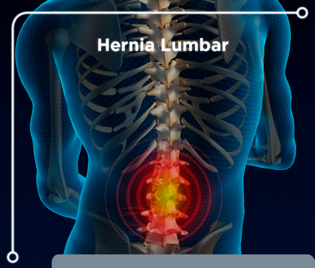 Lumbares Y Pelvis – Osteopatía Atlas